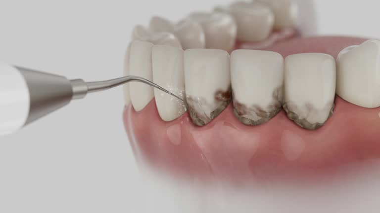 Reliable Emergency Dentist contractor in Fulton, NY by Smile Center Dentistry